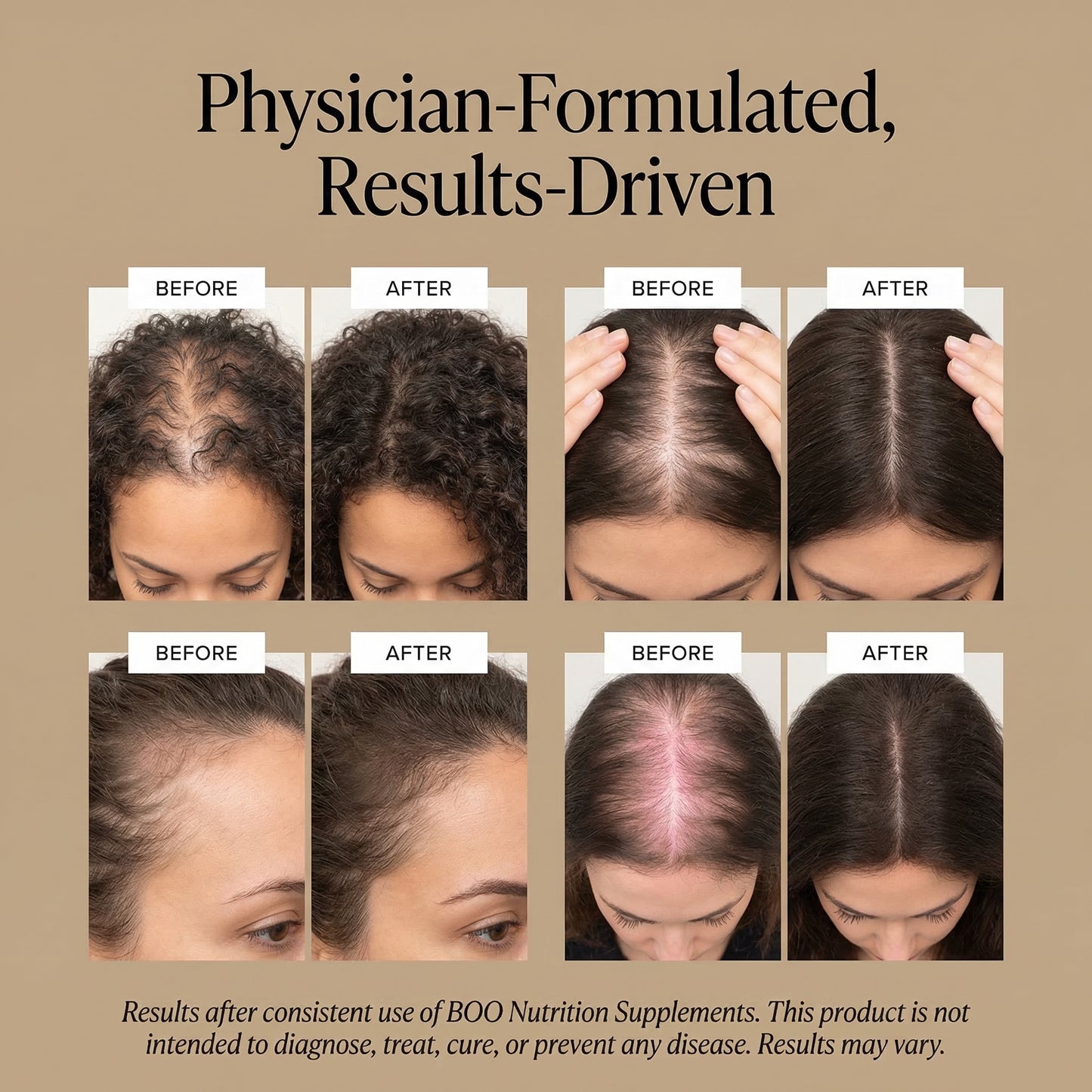Hair Rescue | Hair Growth Nutraceutical