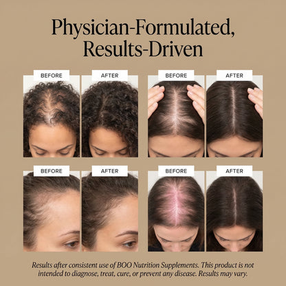 Hair Rescue | Hair Growth Nutraceutical